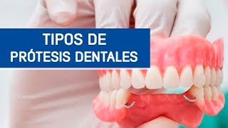 Tipos de prótesis dentales  Odontoespecialistas [upl. by Eirrac]