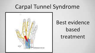 Carpal Tunnel Syndrome [upl. by Anilec]