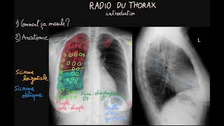 Radio du thorax  Introduction  Partie 1  Docteur Synapse [upl. by Shandy460]