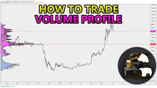 How to Trade Volume Profile VPVR VWAP  and VPSR Analysis Stocks Crypto Forex [upl. by Kalikow]