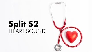 Fixed Split S2  Heart Sounds  MEDZCOOL [upl. by Eiggep]