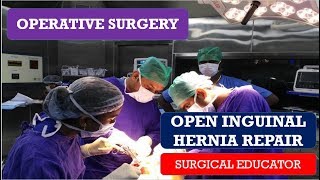 OPEN INGUINAL HERNIA REPAIR STEP BY STEP Operative Surgery [upl. by Hedi126]