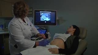 Your First OB Ultrasound  Oakdale OBGYN [upl. by Eilrahc170]