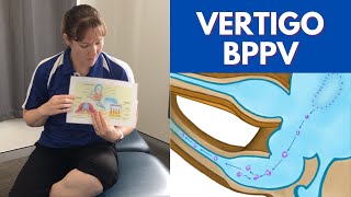 Benign Paroxysmal Positional Vertigo BPPV  Physiotherapy Treatment [upl. by Leann552]