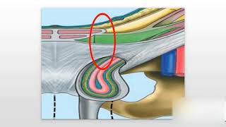 Inguinal Hernias Explained [upl. by Frye976]