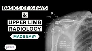 Radiological Anatomy Made Easy Basics of XRays and Upper Limb Radiology [upl. by Sucy]