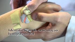 Semiologia do Punho  Testes Ligamentares [upl. by Jereme569]