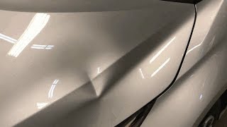 PDR Aluminum Hood Dent [upl. by Zebapda]