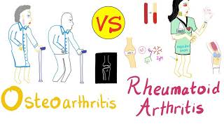 Overview of Rheumatoid arthritis and treatment  Pharmacology [upl. by Atnauqal]