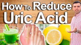 Detoxify Uric Acid and Heal Gout Completely  Uric Acid Treatment Foods and Natural Remedies [upl. by Ynnek]