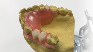 How To Make A Fiber Flex™ Partial  The Entire Process  Dental Lab Learning [upl. by Amzaj]