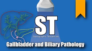 Gallbladder and Biliary Pathology [upl. by Landbert]