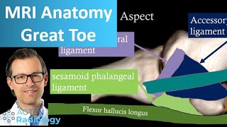 Outer Foot Pain with Plantar Fasciitis [upl. by Leifeste]