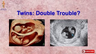 Twins Double Trouble [upl. by Miriam]