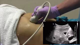 Abdominal Ultrasound Scanning Technique for the Beginner [upl. by Oicangi]