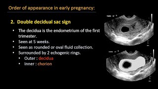 Ultrasound of normal early pregnancy [upl. by Nahtnamas375]