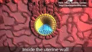 Embyro Implantation [upl. by Hnamik]