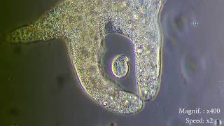 Amoeba eats paramecia  Amoebas lunch   Amoeba Endocytosis  Phagocytosis Part 1  👌 [upl. by Ashatan]