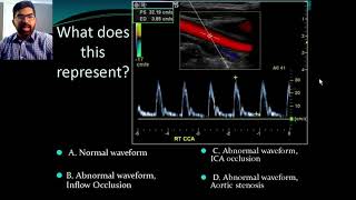 Bronchial and Vesicular Breath Sounds [upl. by Bobbee]