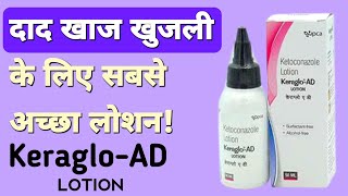 Keraglo AD Lotion How To Use For Skin In Hindi  Fungal Infection Treatment Through Ketoconazole [upl. by Stephine]