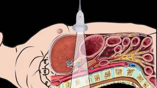 How I do it Ultrasound of the Abdomen [upl. by Lanni]