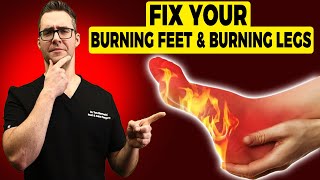 🔥Burning Legs amp Burning Feet at Night Treatment amp Home Remedies🔥 [upl. by Annuahs723]