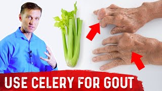 Celery Benefits for Gout – DrBerg [upl. by Ahsatniuq]