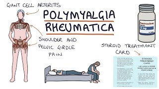 Learn how to manage Rheumatoid Arthritis pain [upl. by Ztirf672]