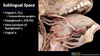 Oral Cavity  Oral Cavity and Sublingual Space [upl. by Aihceyt299]